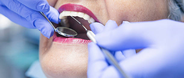 Best Emergency Tooth Extraction in Charleston, WV